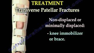 Patellar Fractures  Everything You Need To Know  Dr Nabil Ebraheim [upl. by Asile]