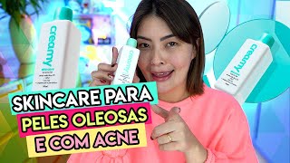 TESTEI A SOLUÇÃO DE ÁCIDO SALICÍLICO 2 ✨ CREAMY 🎉 Pra que serve Vale a pena✨💥 [upl. by Norbel]