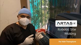 ARTAS 9x Robotic Site Making For Hair Transplant  Musk Clinic [upl. by Germana]