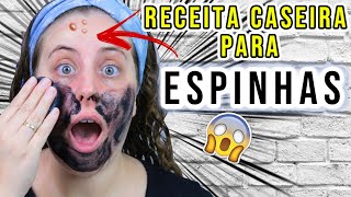 COMO FAZER RECEITAS CASEIRA PARA AS ESPINHAS  CHEGA DE ESPINHAS [upl. by Hibben]