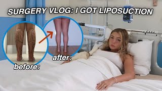 SURGERY VLOG I GOT LIPOSUCTION it was hell [upl. by Bosch]