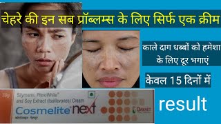 चेहरे के काले दाग धब्बों के लिए बेस्ट क्रीमcosmelite next cream review usesdosageside effects [upl. by Yanrahs]