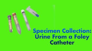 Specimen Collection Urine from a Foley Catheter [upl. by Lehcer983]