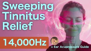 Tinnitus Relief Sweeping Sound at 14000Hz  Head Tinnitus Acupressure Ear Acupoints [upl. by Killy379]