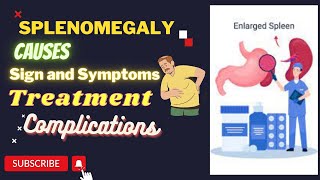 Splenomegaly Causes Sign And symptoms  Treatment complications Urdu  Hindi [upl. by Wivinia938]