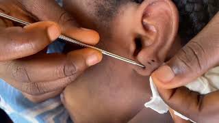 ASMR AGGRESSIVE INTENSE SCALP SCRATCHING AND MASSAGE EAR MASSAGE [upl. by Rickey]