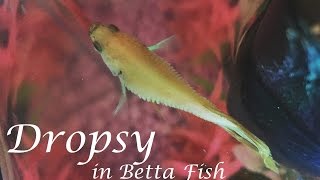 Dropsy in Betta Fish  Symptoms Prevention Life Expectancy amp More [upl. by Nij147]