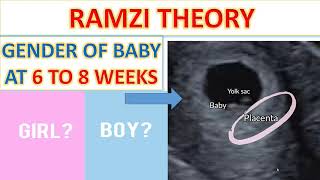 GENDER DETECTION AT 6 TO 8 WEEKS SCAN GENDER DETECTION AT EARLIER SCAN  RAMZI THEORY BOY OR GIRL [upl. by Notlim]