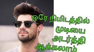 hair transplant tamil hair density trick look like Vijay [upl. by Anne]