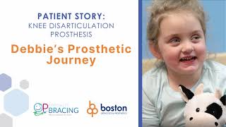 Debbies Prosthetic Story at Boston OampP a division of OPSB [upl. by Londoner]