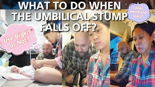 Newborn Umbilical Stump Falls Off What To Do First Time Parents Reaction [upl. by Nevear]