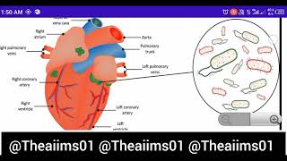 Endocarditis Cardiovascular diseasesdisorders [upl. by Pylle]