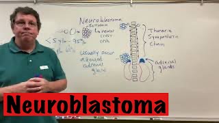 Neuroblastoma [upl. by Ynomrah]