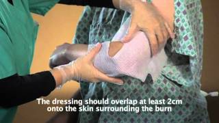 AQUACEL® Ag Burn  Elbow application [upl. by Goer]