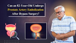 Prostate Artery Embolization in Hyderabad  NonSurgical Treatment  Prostate Surgery nonsurgical [upl. by Lena]