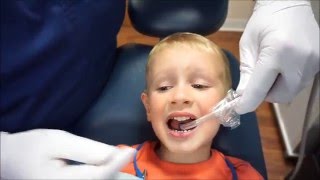 Fluoride Varnish Application [upl. by Erihppas8]