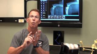 Canine ACL Tears and TPLO Surgery discussed by Dr Bauer DVM DACVS [upl. by Ained428]