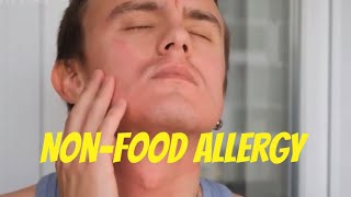 NonFood Allergy [upl. by Ulrica]