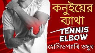 কনুই ব্যথার হোমিও ঔষধ  tennis elbow treatment  Dr Manabendra Mondal [upl. by Erika273]