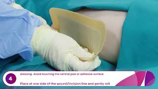 How to Apply and Remove Aquacel® Ag Surgical Dressings Hip [upl. by Eynaffit649]