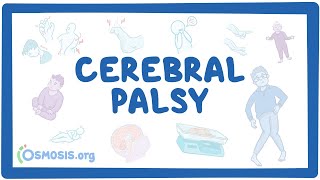 Cerebral palsy CP  causes symptoms diagnosis treatment pathology [upl. by Nahrut342]