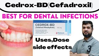 CedroxBD tabletsCefadroxil for Dental InfectionsURTIs Uses lDose l Side effects [upl. by Daryn]