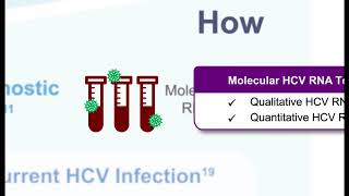 Hepatitis C Virus From Screening to Cure [upl. by Mikeb921]