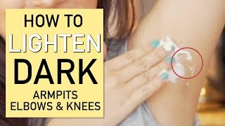 How To Lighten Dark Armpits Elbows and Knees [upl. by Fronnia59]