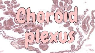 Choroid plexus  nervous system histology [upl. by Rengia]