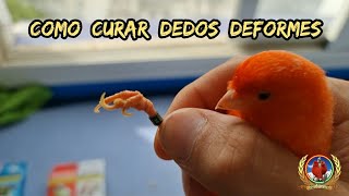 Como curar dedos deformes y patas de rana 🐸 en canarios 🐥 [upl. by Nodnek]