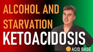 Alcoholic And Starvation Ketoacidosis [upl. by Noirad]