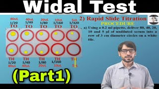 Widal Test Part1  Rapid Screening and Rapid Slide Titration Procedure [upl. by Llebiram854]