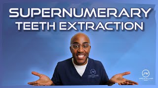 Tips On How To Perform Supernumerary Teeth Extraction [upl. by Lienaj]