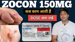 zocon 150  zocon 150 is used for in hindi  zocon 150 tablet  zocon 150 fluconazole [upl. by Gnilsia]