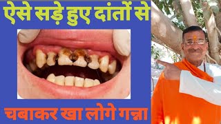 ऐसे सड़े हुए दांतों से चबाकर खा लोगे गन्ना how to get rid of cavity without going to the dentist [upl. by Essirahs]