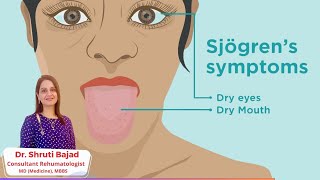 Sjogrens Syndrome  Dr Shruti Bajad  skincare arthritis [upl. by Derron292]