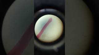 Ancylostoma whole mount zoology practical lab 🧪shorts [upl. by Etteroma]