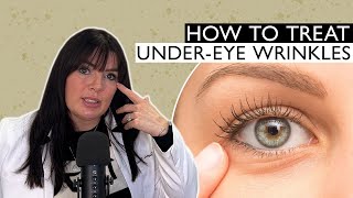 How To Treat Under Eye Wrinkles And Crepeyness [upl. by Tamah]