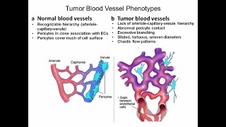 Targeting Cancer Pathways Tumor Metabolism and Proliferation [upl. by Arraes]