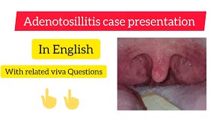 Adenotonsilitis case presentation  ENT  MBBS [upl. by Mosi145]