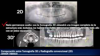 Comparacion entre Tomografia 3D Y Radiografia Convencional 2D Ventajas de la Tecnología 3D [upl. by Cletis]