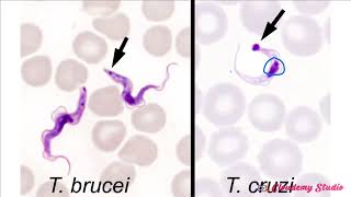 TRYPANOSOMA CRUZI [upl. by Nial12]