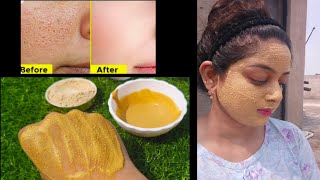 Face Pack For Glowing Skin Homemade  Multani Mitti Face Pack Skin Glowing For All Skin Types [upl. by Elvyn]