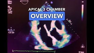 Apical 3 Chamber View  Echocardiography Education [upl. by Anelrahs]