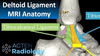 MRI Anatomy of Ankle Ligaments Deltoid Ligament [upl. by Killarney]