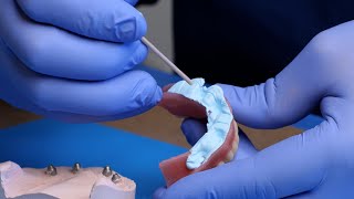 Locating Abutments  Smart Denture Conversions Training [upl. by Airamesor]