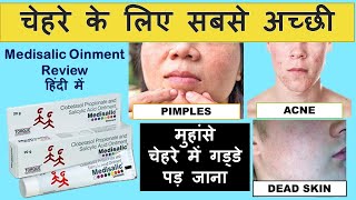 Medisalic Cream Review in hindi safe or unsafe Clobetasol propionate amp salicylic acid ointment [upl. by Atihana]