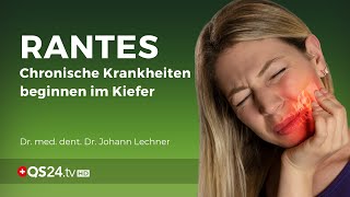 RANTES chronische Krankheiten beginnen im Kiefer  Dr med dent Dr Johann Lechner  NaturMEDIZIN [upl. by Essie]