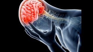 Treating Traumatic Brain Injury With Hormone Therapy [upl. by Judith]