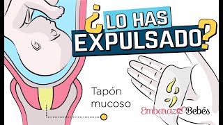 💦🧻 TAPÓN MUCOSO ¿Qué es y cuándo se expulsa ¿Es señal de parto [upl. by Enram]